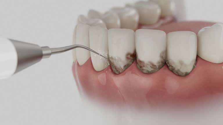 Reliable Root Canal Treatment contractor in Ballard County County, KY by Dentist Open Now